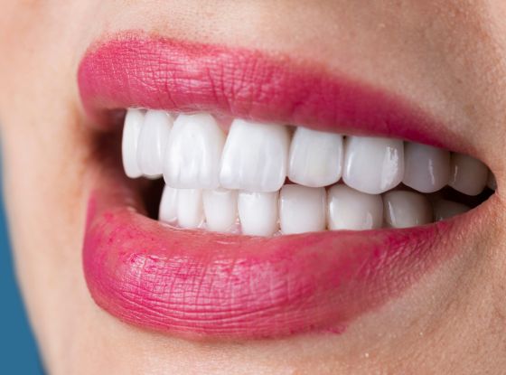 The Benefits of Dental Veneers for Improving Your Smile